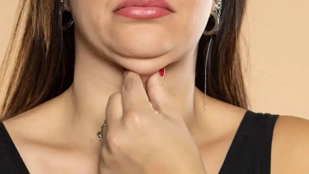An image of a woman with double chin, sad, worried : Non Surgical Double Chin Removal Treatment in Newark, UK