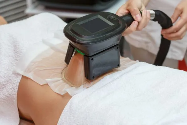 Image of person having fat freezing treatment to help weight gain Newark