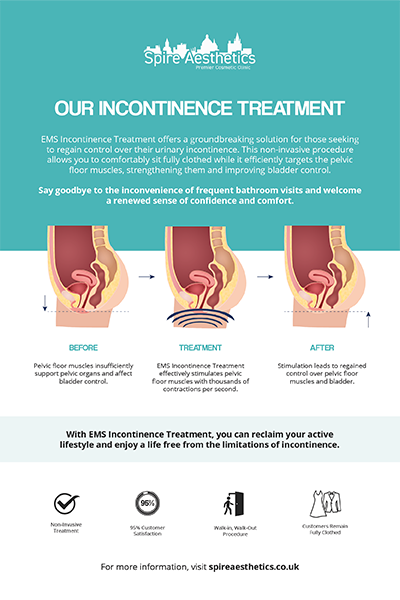 image to show how EMS treatment works for female urinary incontinence Newark
